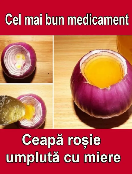 Ai răcit? Încearcă rețeta tradițională a bunicilor, ceapa și miere